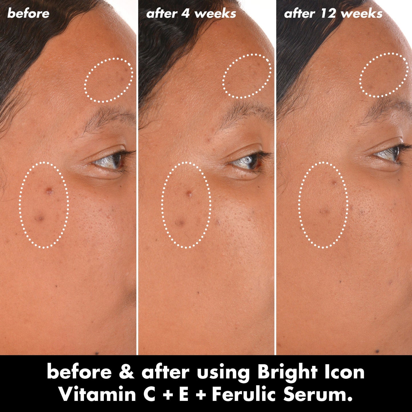 bright-icon-vitamin-c-e-ferulic-serum-y5 0226_EDU_BrightIconVitC_BA_Chanel_TRIPTYCH_c58f2fc8-209d-414f-9ba3-666a07a94887.jpg