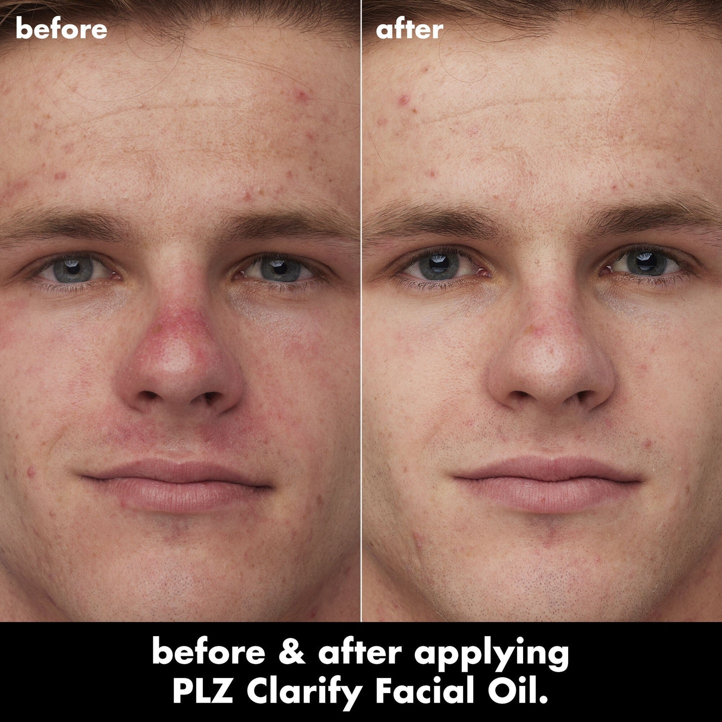 plz-clarify-facial-oil-p0 0326_EDU_PlzClarify_BA_Caleb.jpg