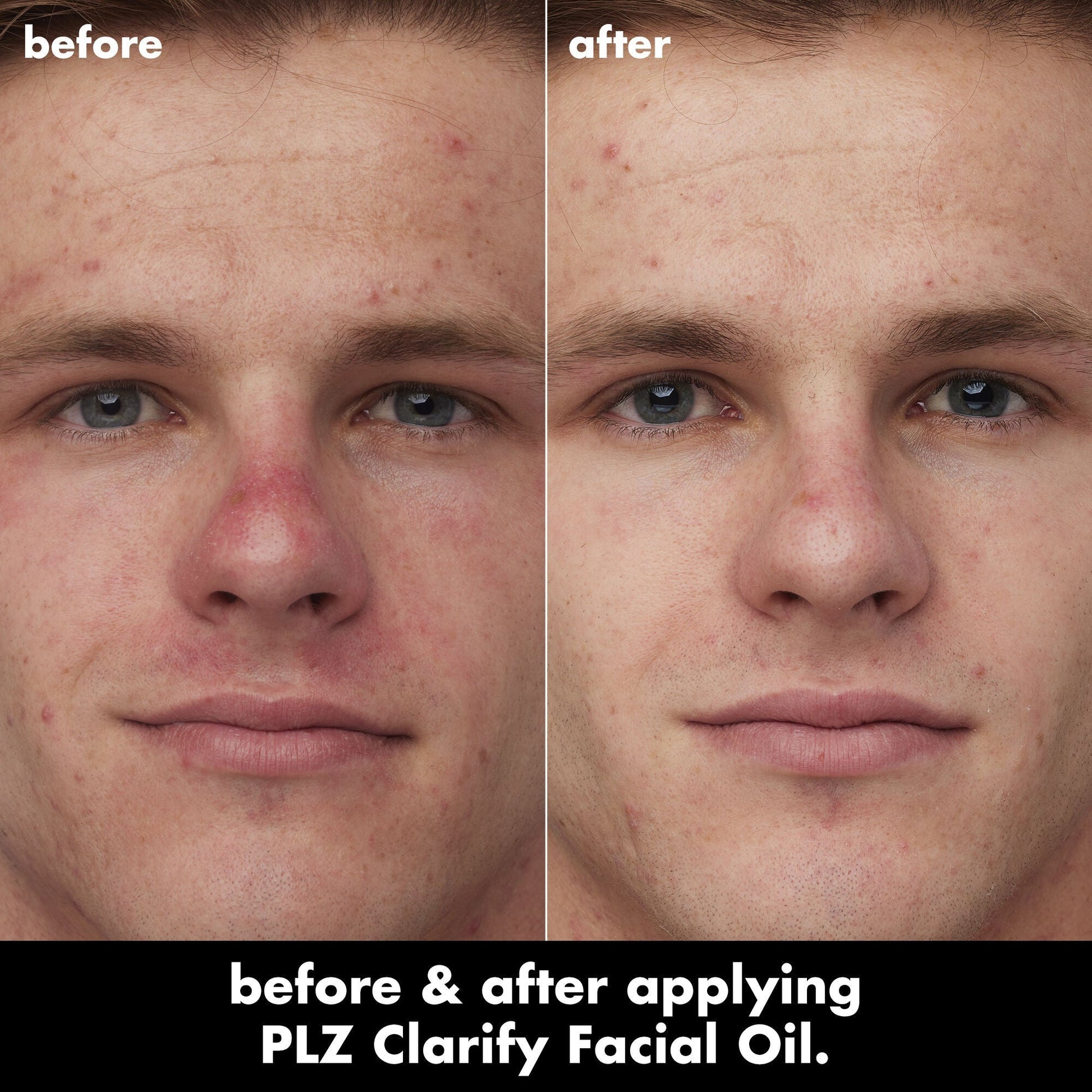 plz-clarify-facial-oil-p0 0326_EDU_PlzClarify_BA_Caleb.jpg