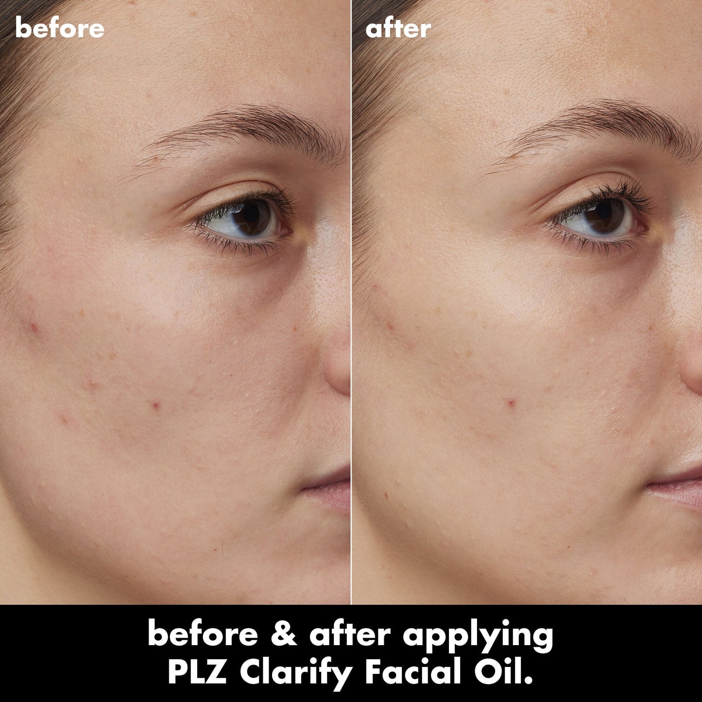 plz-clarify-facial-oil-p0 0326_EDU_PlzClarify_BA_Kelly.jpg