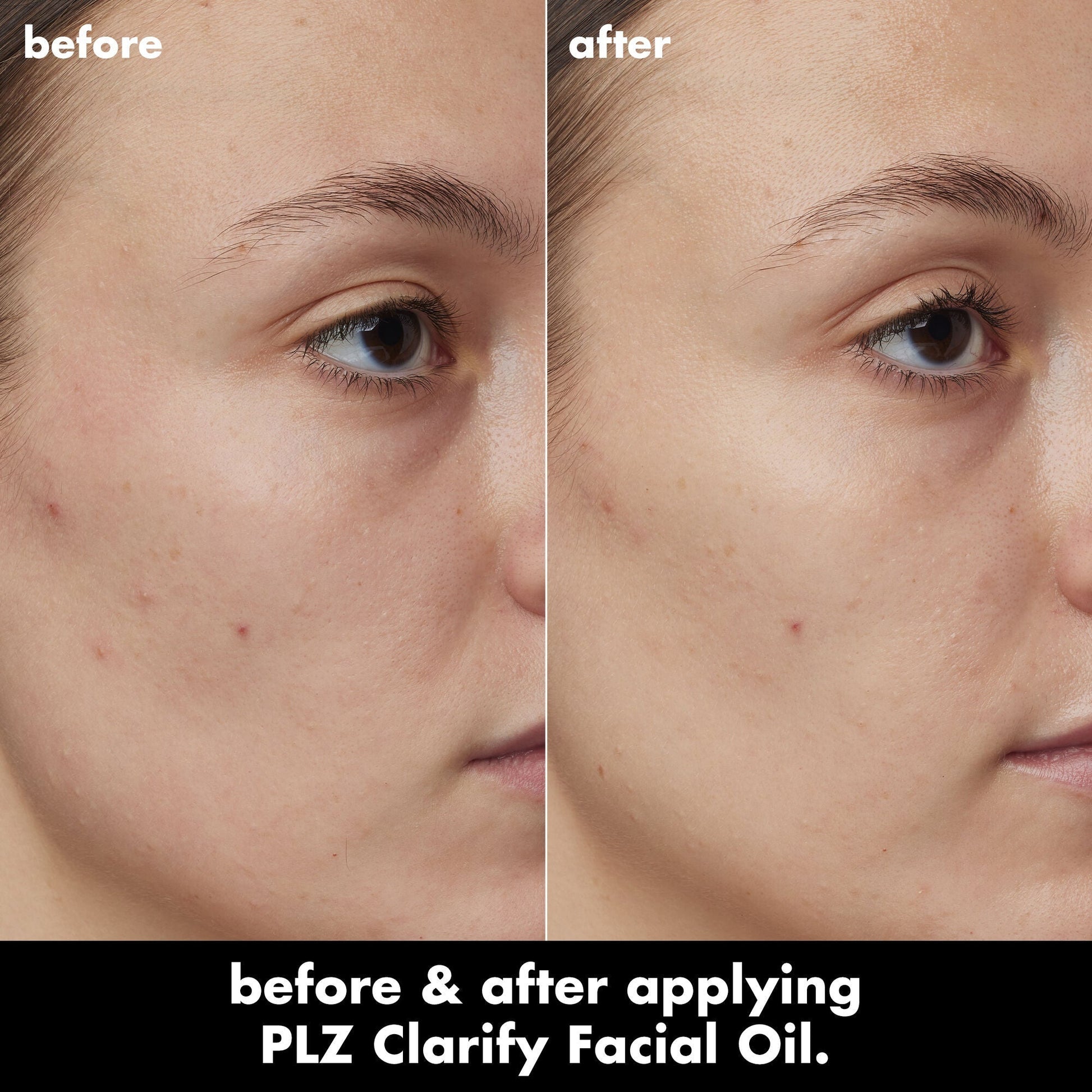 plz-clarify-facial-oil-p0 0326_EDU_PlzClarify_BA_Kelly.jpg