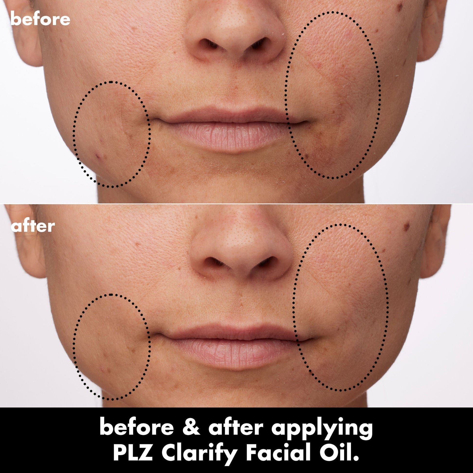 plz-clarify-facial-oil-p0 0326_EDU_PlzClarify_BA_Paula.jpg
