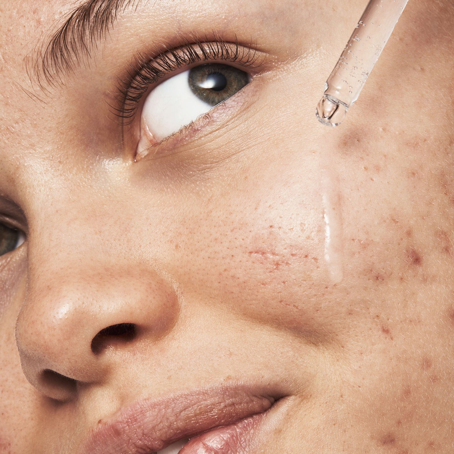 blemish-breakthrough-triple-acid-resurfacing-serum-l2 121321_Marley-Acne-Regimen_0254_FINAL_IGF.jpg