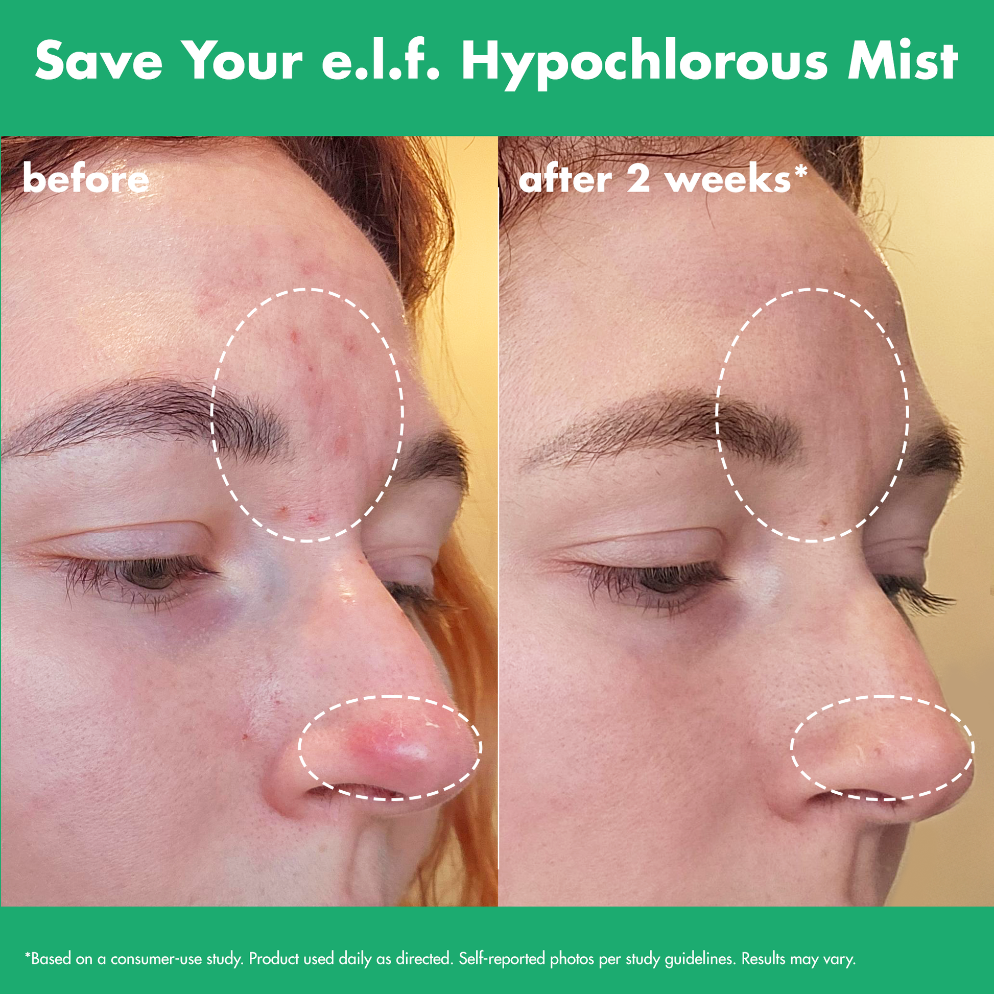 save-your-e-l-f-hypochlorous-mist-p0 FA26_EDUCATION_SAVEYOURELF_USAGE_BA1_WITHOUT_CLAIMS.png
